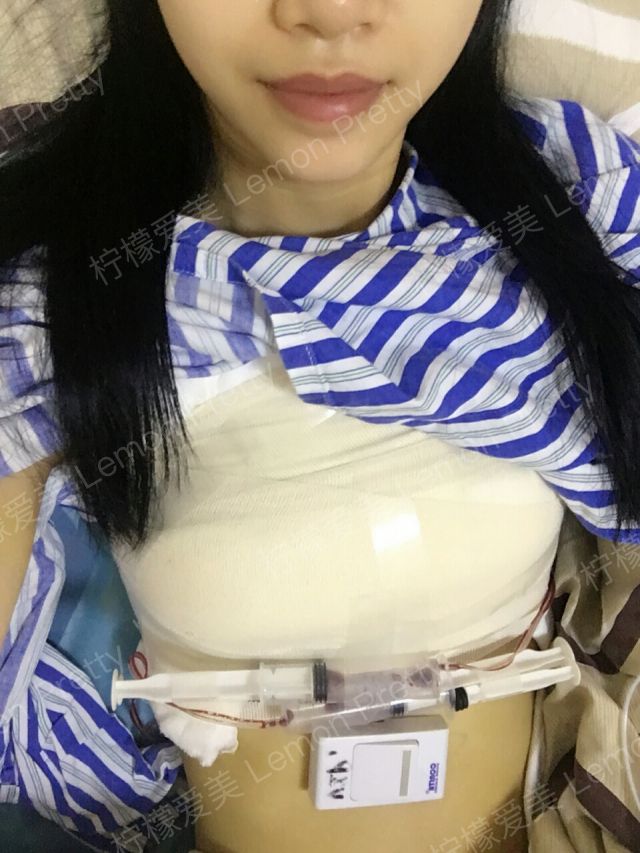 隆胸后取出来胸会怎样