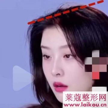 女明星动了这个地方之后，颜值一下子提高了两个档次~