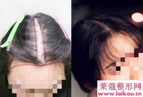 女明星动了这个地方之后，颜值一下子提高了两个档次~